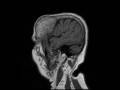 IMG-0011-00001