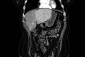 ct1