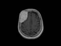 IMG-0010-00001